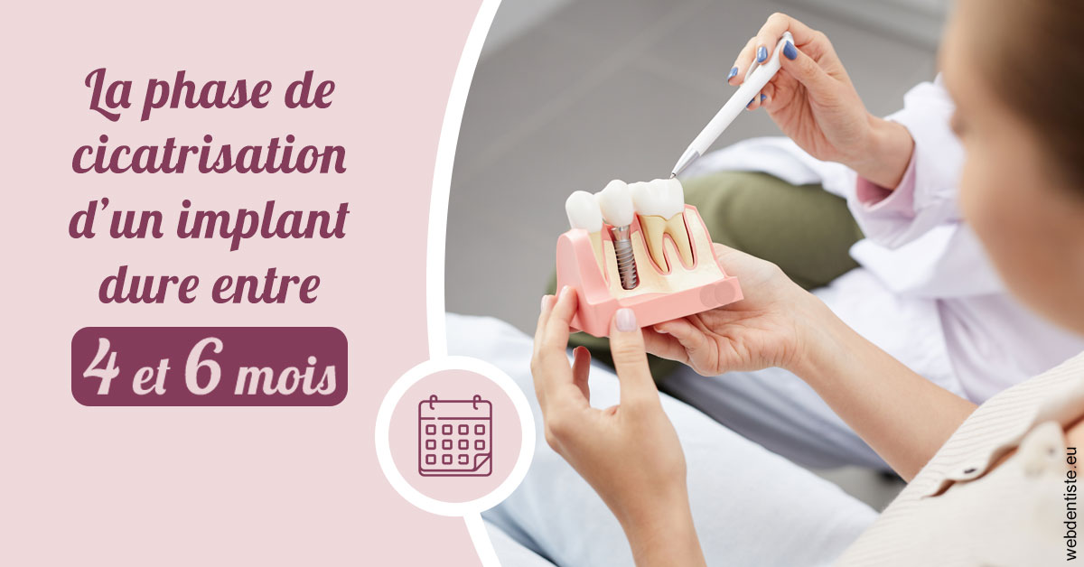 https://dr-guerrier-thierry.chirurgiens-dentistes.fr/Cicatrisation implant 2