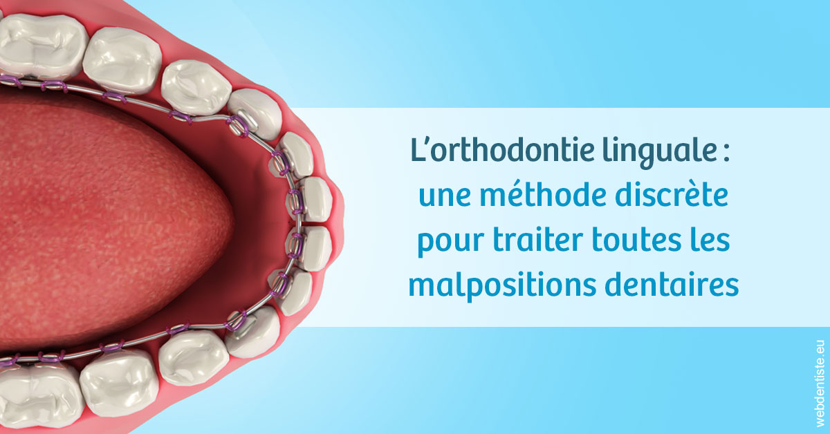 https://dr-guerrier-thierry.chirurgiens-dentistes.fr/L'orthodontie linguale 1