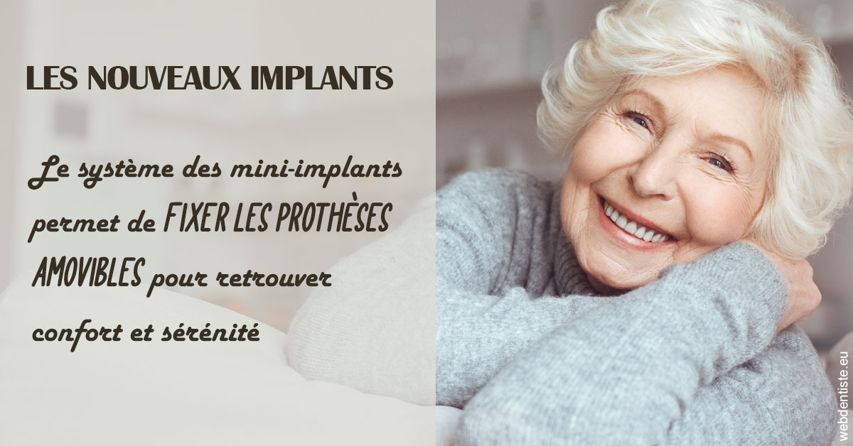 https://dr-guerrier-thierry.chirurgiens-dentistes.fr/Les nouveaux implants 1