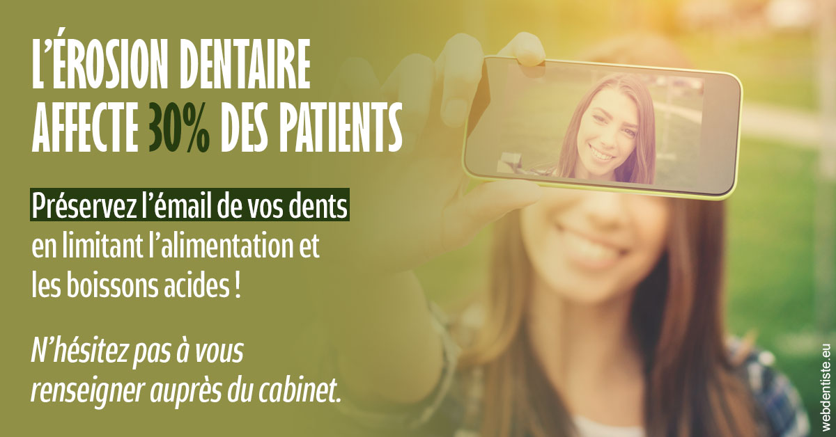 https://dr-guerrier-thierry.chirurgiens-dentistes.fr/L'érosion dentaire 1