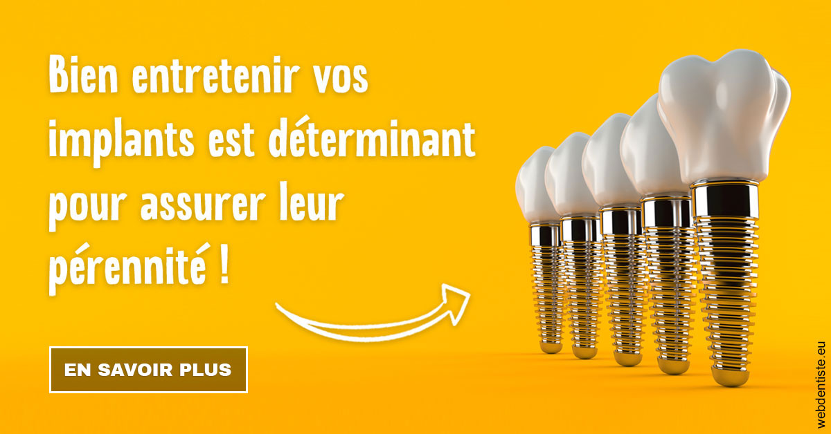 https://dr-guerrier-thierry.chirurgiens-dentistes.fr/Entretien implants 2