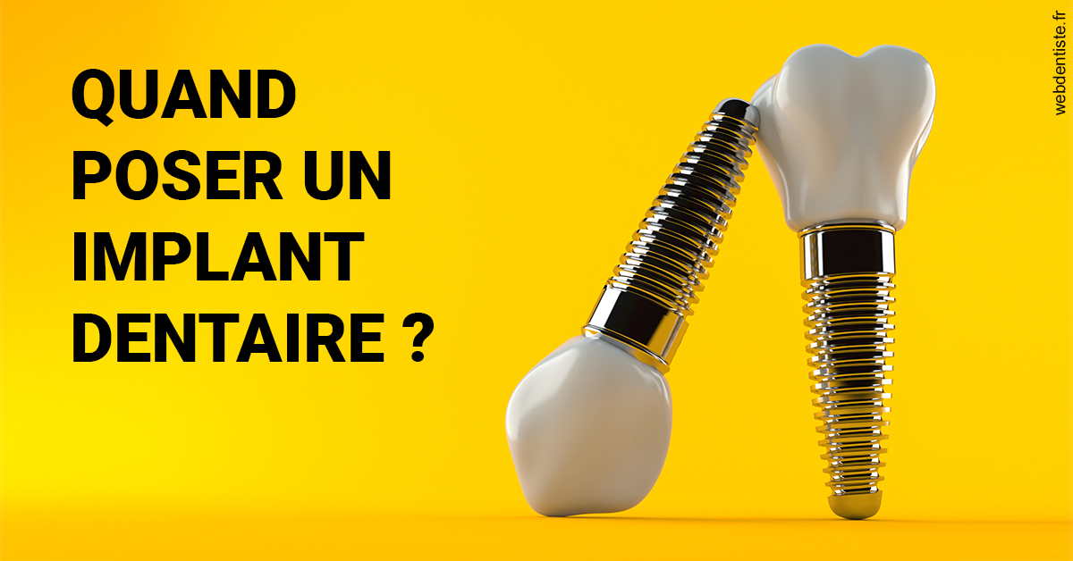 https://dr-guerrier-thierry.chirurgiens-dentistes.fr/Les implants 2