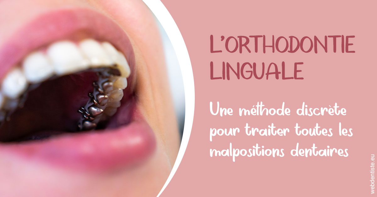 https://dr-guerrier-thierry.chirurgiens-dentistes.fr/L'orthodontie linguale 2