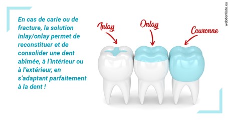 https://dr-guerrier-thierry.chirurgiens-dentistes.fr/L'INLAY ou l'ONLAY