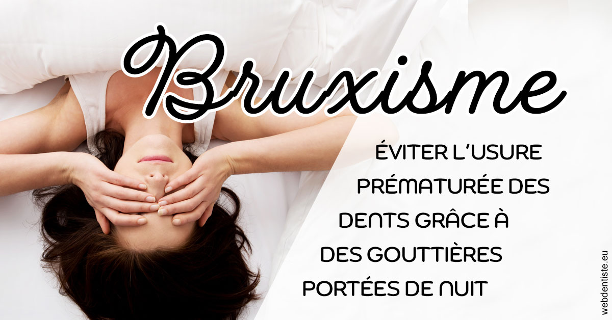 https://dr-guerrier-thierry.chirurgiens-dentistes.fr/Bruxisme 2