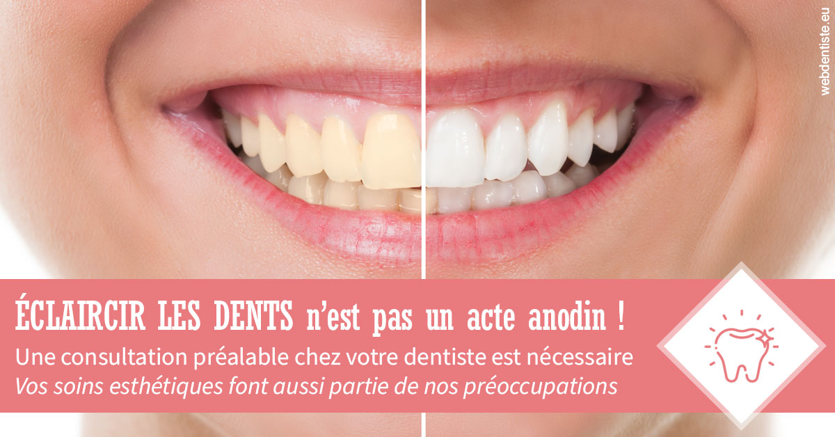 https://dr-guerrier-thierry.chirurgiens-dentistes.fr/Eclaircir les dents 1