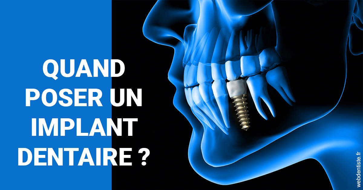 https://dr-guerrier-thierry.chirurgiens-dentistes.fr/Les implants 1