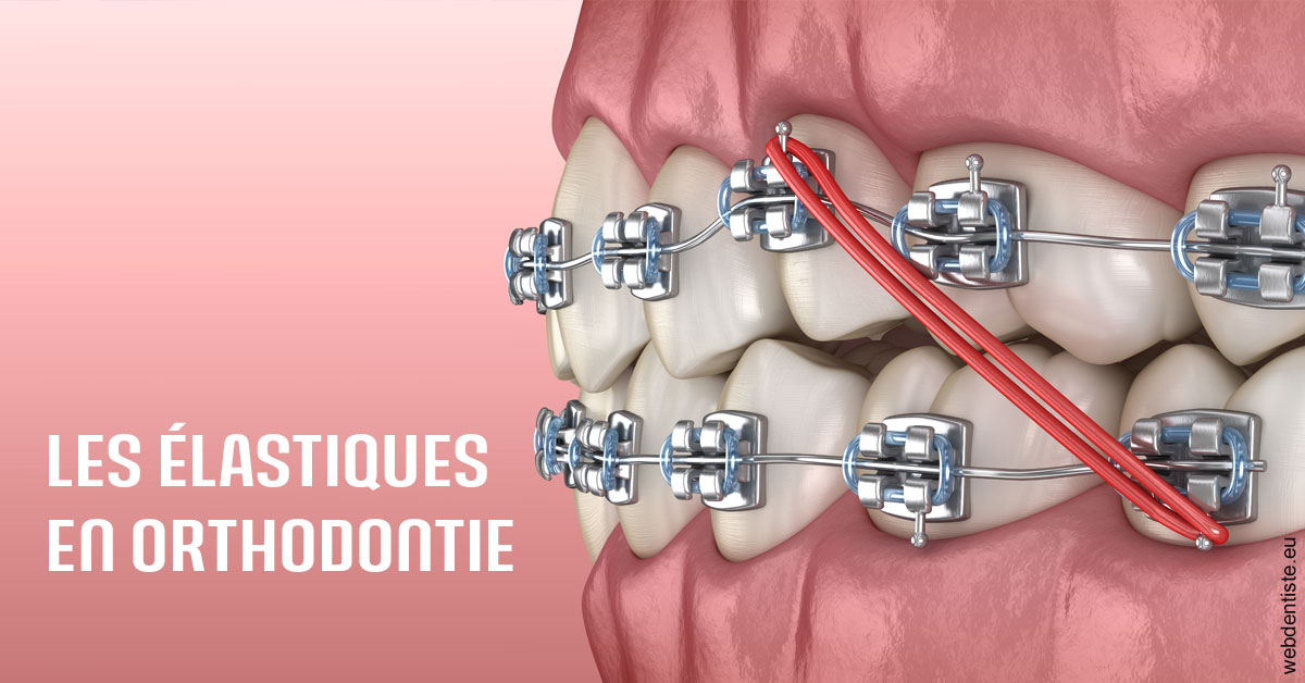 https://dr-guerrier-thierry.chirurgiens-dentistes.fr/Elastiques orthodontie 2
