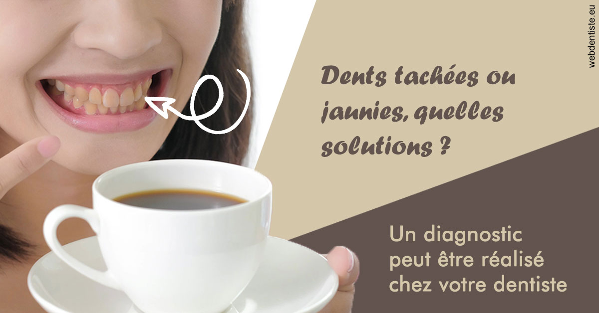 https://dr-guerrier-thierry.chirurgiens-dentistes.fr/Dents tachées 1