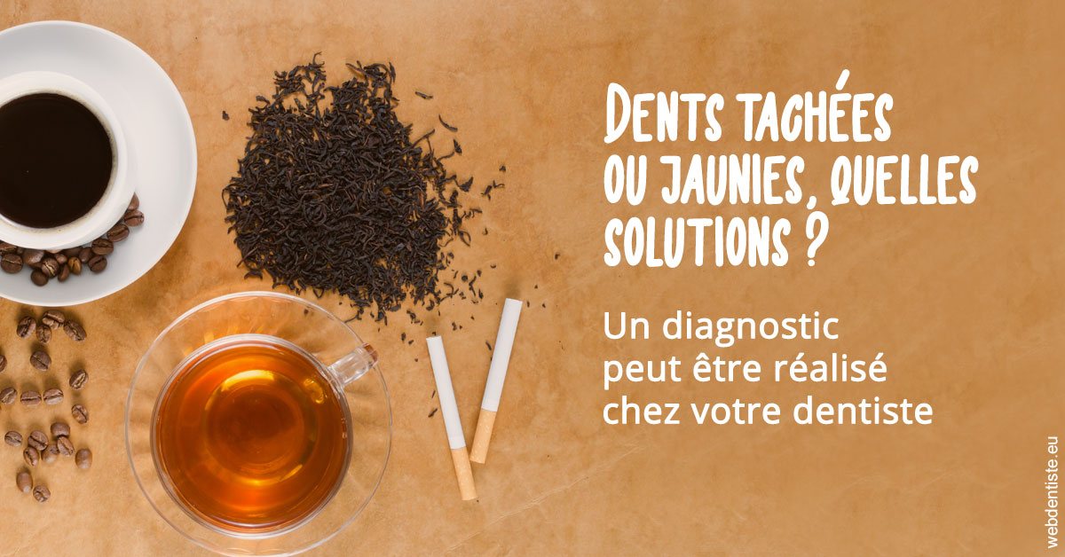 https://dr-guerrier-thierry.chirurgiens-dentistes.fr/Dents tachées 2