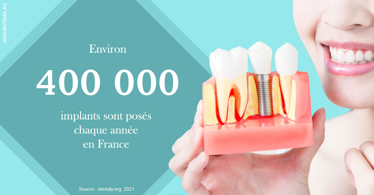https://dr-guerrier-thierry.chirurgiens-dentistes.fr/Pose d'implants en France 2